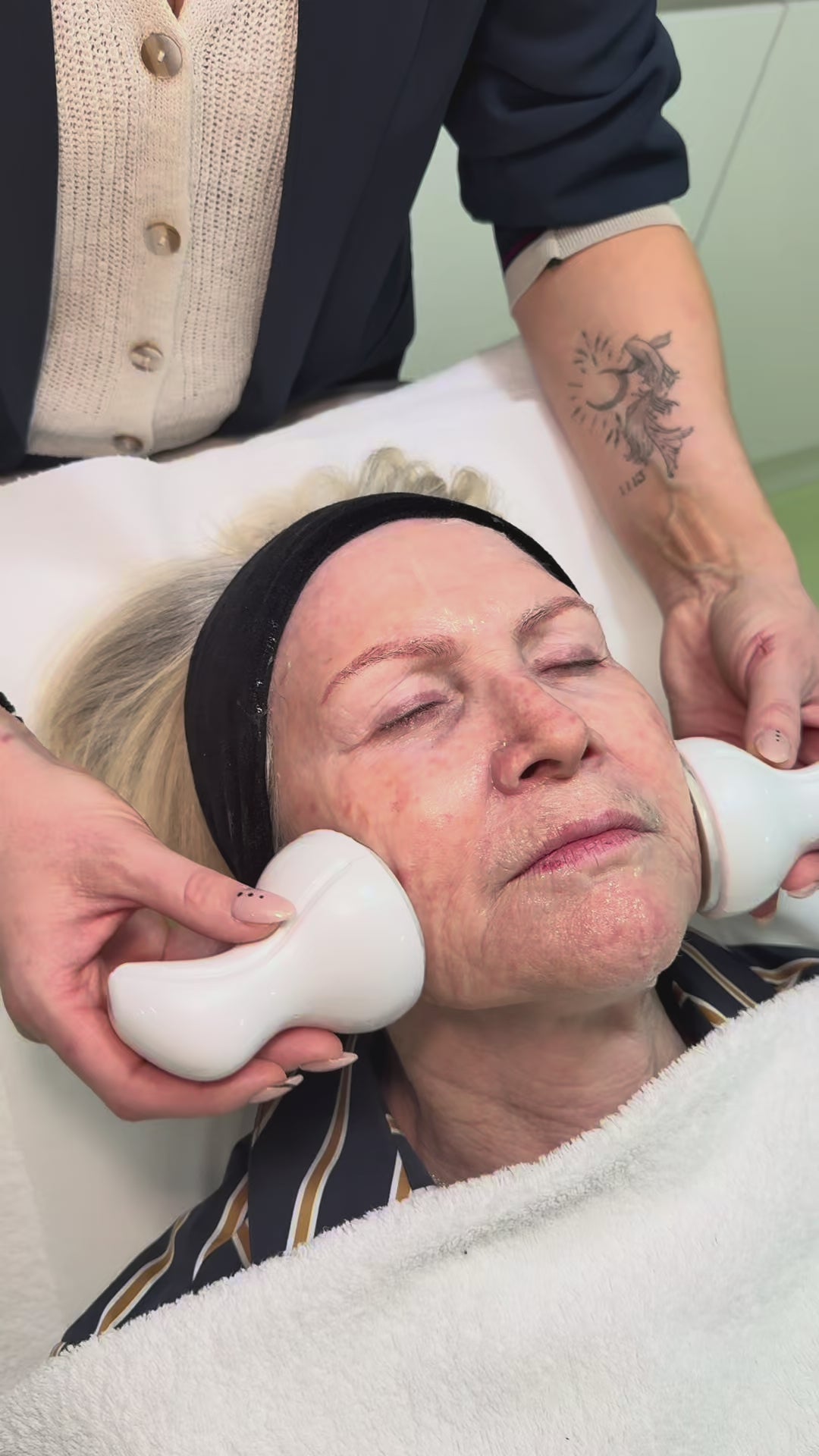 CLINICAL CryoCalm